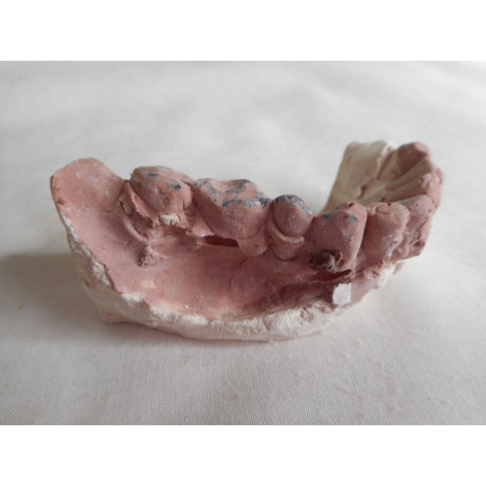 Vintage Cast Dental Teeth Mold  Tooth Castings #12